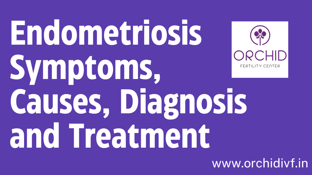 Endometriosis Symptoms, Causes, Diagnosis and Treatment